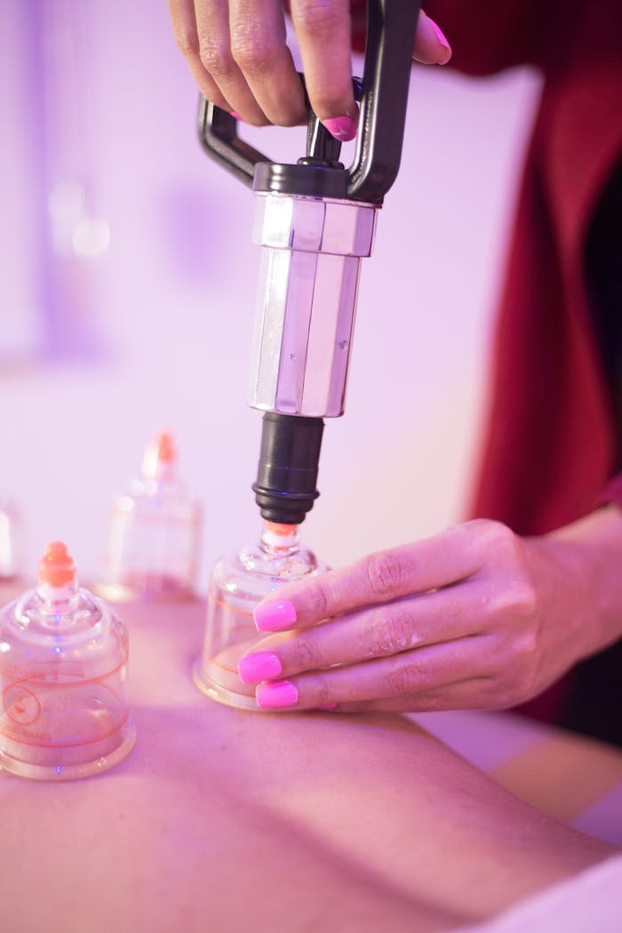home-img Close-up view of a professional cupping therapy session in a spa, focusing on health and relaxation.